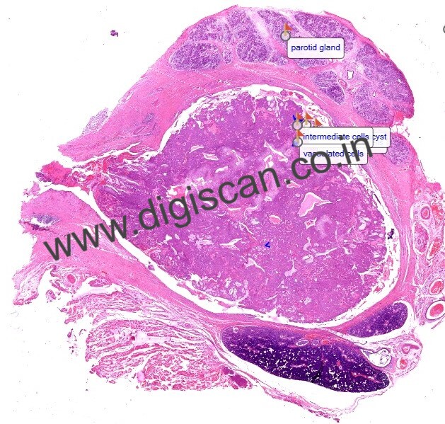 Oral Pathology Digital Slides Set (MDS & PG Students)